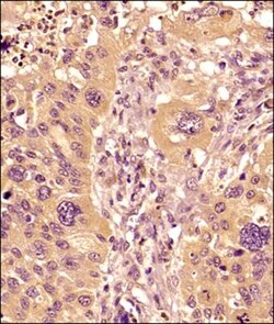 MMP-9 Antibody (4A3), Novus Biologicals:Antibodies:Primary Antibodies