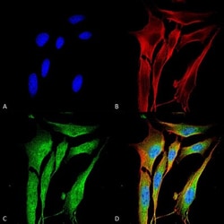 MMP-9 Antibody (S51-82), Novus Biologicals 100ug; Unlabeled:Antibodies,