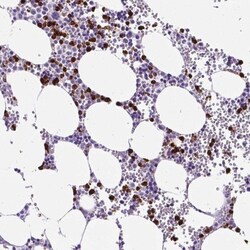 MMP-9 Antibody, Novus Biologicals 0.1mL; Unlabeled:Antibodies, Polyclonal