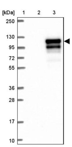 MMP-9 Antibody, Novus Biologicals 0.1mL; Unlabeled:Antibodies, Polyclonal