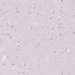 MMR/CD206/Mannose Receptor Antibody, Novus Biologicals 25 &mu;L; Unlabeled:Antibodies,