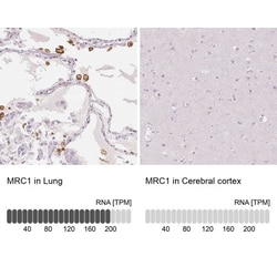 MMR/CD206/Mannose Receptor Antibody, Novus Biologicals 25 &mu;L; Unlabeled:Antibodies,