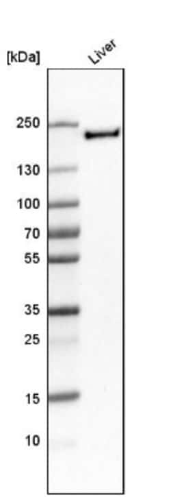 MMR/CD206/Mannose Receptor Antibody, Novus Biologicals 25 &mu;L; Unlabeled:Antibodies,