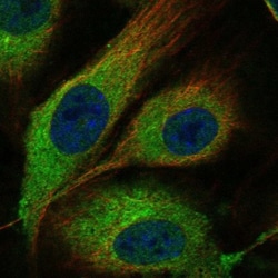 MMRN1 Antibody, Novus Biologicals 25 &mu;L; Unlabeled:Antibodies, Polyclonal