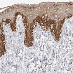 MMRN1 Antibody, Novus Biologicals 25 &mu;L; Unlabeled:Antibodies, Polyclonal