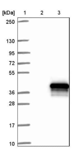 MMTAG2 Antibody, Novus Biologicals 25 &mu;L | Buy Online | Novus Biologicals | Fisher Scientific