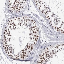 MNAT1 Antibody, Novus Biologicals 25 &mu;L; Unlabeled:Antibodies, Polyclonal