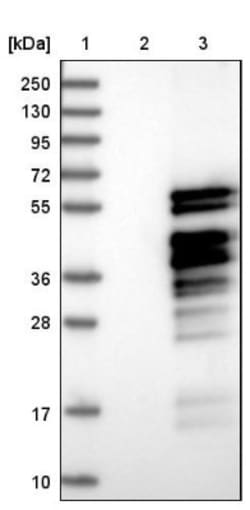MNDA Antibody, Novus Biologicals:Antikroppar:Primära antikroppar