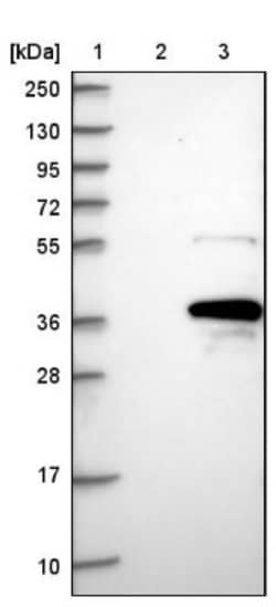 MOGAT2 Antibody, Novus Biologicals 0.1mL; Unlabeled:Antibodies, Polyclonal