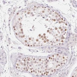 MORC1 Antibody, Novus Biologicals:Antibodies:Primary Antibodies