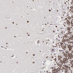 MORC2 Antibody, Novus Biologicals 0.1mL; Unlabeled:Antibodies, Polyclonal