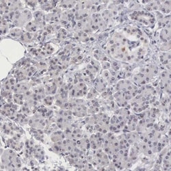 MORC2 Antibody, Novus Biologicals 0.1mL; Unlabeled:Antibodies, Polyclonal