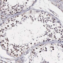 MORC2 Antibody, Novus Biologicals 0.1mL; Unlabeled:Antibodies, Polyclonal