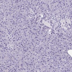 MORC4 Antibody, Novus Biologicals:Antibodies:Primary Antibodies