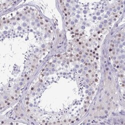 MORC4 Antibody, Novus Biologicals:Antibodies:Primary Antibodies