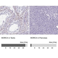 MORC4 Antibody, Novus Biologicals:Antibodies:Primary Antibodies