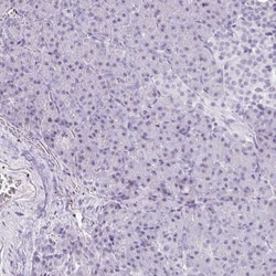 MORC4 Antibody, Novus Biologicals:Antibodies:Primary Antibodies