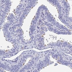 MORN2 Antibody, Novus Biologicals 25 &mu;L, Unlabeled:Antibodies, Polyclonal