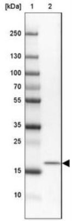 MORN4 Antibody, Novus Biologicals 25 &mu;L, Unlabeled:Antibodies, Polyclonal