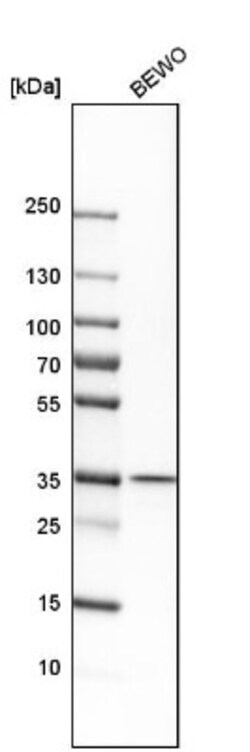 MOSC1 Antibody, Novus Biologicals:Antibodies:Primary Antibodies
