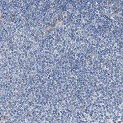 MOSC2 Antibody, Novus Biologicals 0.1mL; Unlabeled:Antibodies, Polyclonal