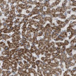 MOSC2 Antibody, Novus Biologicals 0.1mL; Unlabeled:Antibodies, Polyclonal
