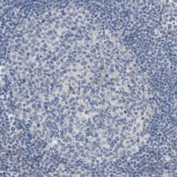 MOSC2 Antibody, Novus Biologicals 0.1mL; Unlabeled:Antibodies, Polyclonal