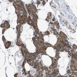 MOSC2 Antibody, Novus Biologicals 0.1mL; Unlabeled:Antibodies, Polyclonal