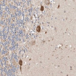 MOSPD1 Antibody, Novus Biologicals 0.1mL; Unlabeled:Antibodies, Polyclonal