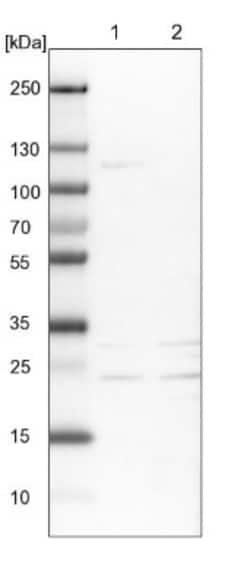 MOSPD1 Antibody, Novus Biologicals 0.1mL; Unlabeled:Antibodies, Polyclonal