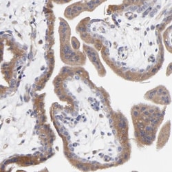 MOSPD2 Antibody, Novus Biologicals 25 &mu;L, Unlabeled:Antibodies, Polyclonal