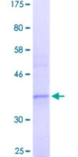 Novus Biologicals Recombinant Human MOX1 GST (N-Term) Protein 25 &mu;g | Buy Online | Novus Biologicals&trade; | Fisher Scientific