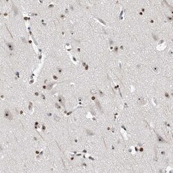 MPHOSPH10 Antibody, Novus Biologicals 25 &mu;L; Unlabeled:Antibodies, Polyclonal