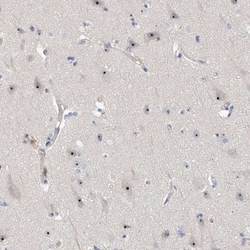 MPHOSPH10 Antibody, Novus Biologicals 25 &mu;L, Unlabeled:Antibodies, Polyclonal
