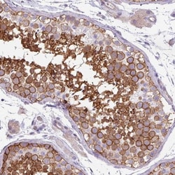 VAM1 Antibody, Novus Biologicals 25 &mu;L; Unlabeled:Antibodies, Polyclonal