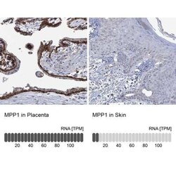 MPP1 Rabbit anti-Human, Polyclonal, Novus Biologicals:Antibodies:Primary