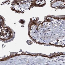 MPP1 Rabbit anti-Human, Polyclonal, Novus Biologicals:Antibodies:Primary