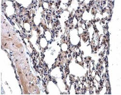 MPP3 Antibody, Novus Biologicals 0.1mL; Unlabeled:Antibodies, Polyclonal