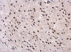 MPP3 Antibody, Novus Biologicals 0.1mL; Unlabeled:Antibodies, Polyclonal
