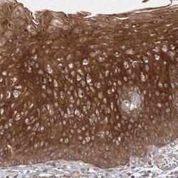MPP7 Antibody, Novus Biologicals 0.1mL; Unlabeled:Antibodies, Polyclonal