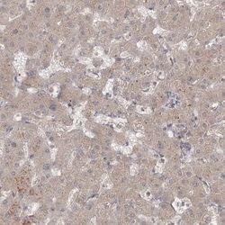 MPP7 Antibody, Novus Biologicals 0.1mL; Unlabeled:Antibodies, Polyclonal