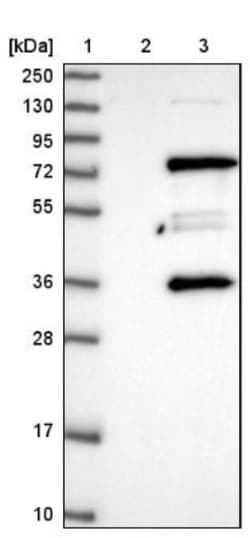 MPP7 Antibody, Novus Biologicals 0.1mL; Unlabeled:Antibodies, Polyclonal