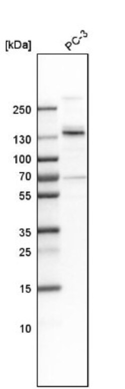 MPRIP Antibody, Novus Biologicals 25 &mu;L; Unlabeled:Antibodies, Polyclonal