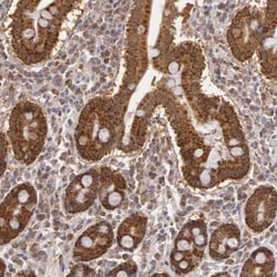 MPST Antibody, Novus Biologicals 0.1mL; Unlabeled:Antibodies, Polyclonal