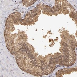 MPST Antibody, Novus Biologicals 0.1mL; Unlabeled:Antibodies, Polyclonal