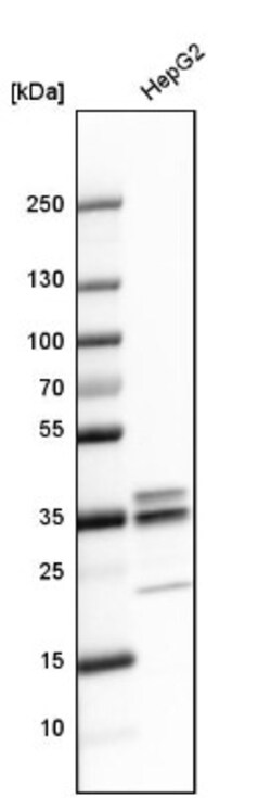 MPST Antibody, Novus Biologicals 0.1mL; Unlabeled:Antibodies, Polyclonal