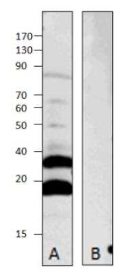 MRAP2 Antibody, Novus Biologicals 100 &mu;g | Buy Online | Novus Biologicals | Fisher Scientific