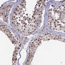 MRG15 Antibody, Novus Biologicals 0.1mL; Unlabeled:Antibodies, Polyclonal