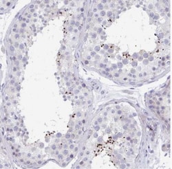 MROH2B Antibody, Novus Biologicals:Antibodies:Primary Antibodies