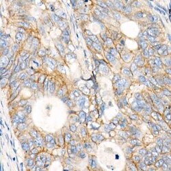 MRP1 Rabbit anti-Human, Mouse, Rat, Clone: 3W1Y4, Novus Biologicals 100